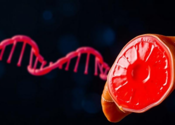 Fatty diets may drive dangerous liver pressure, genetic study suggests