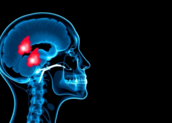 AI Helps Radiologists Diagnose Tricky Salivary Gland Tumors in Landmark Prospective Trial
