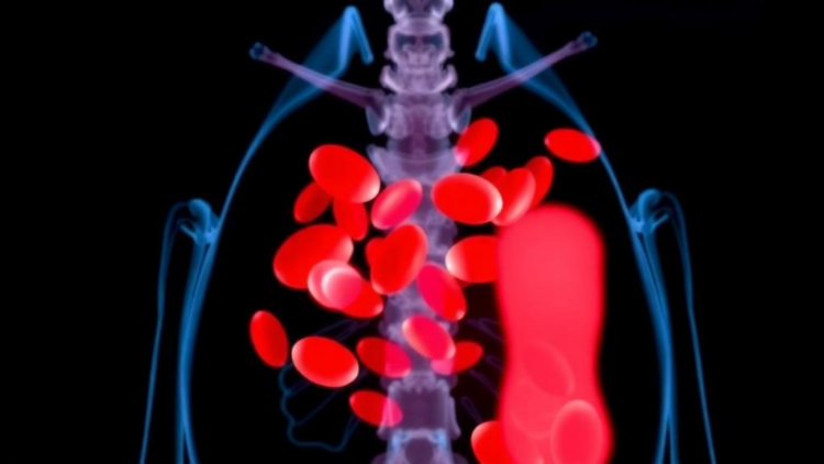 Gallstones in a Seven-Year-Old Revealed Hidden Blood Disorder, Prompting New Diagnostic Algorithm