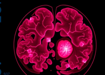 Brain-Inspired AI Spots Breast Cancer in Encrypted Slides With Over 98% Accuracy