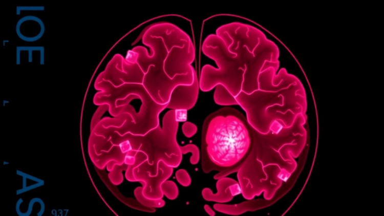 Brain-Inspired AI Spots Breast Cancer in Encrypted Slides With Over 98% Accuracy