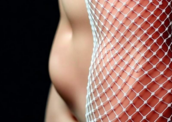 Hybrid Mesh Shows Promise Only in the Toughest Abdominal Wall Reconstructions