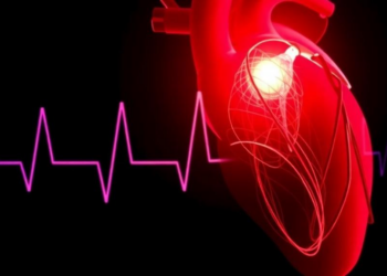 New Trial Evidence Reshapes the Case for Left Atrial Appendage Occlusion in Atrial Fibrillation