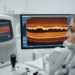 Optical coherence tomography reveals retinal layer thickening in Steinert disease patients