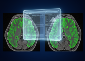 AI Imaging Tools May Look Accurate on Single Photos Yet Fail at Measuring Change Over Time