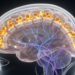 Finasteride Probe Reveals How Androgens Shape Brain Control Circuits in Heavy Drinkers