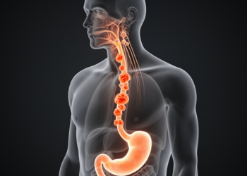 How a ‘Low-Risk’ Esophageal Cancer Defied the Rules and Struck the Neck Within Months