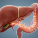 How the Gut-Liver Axis Prepares the Liver for Cancer Metastasis