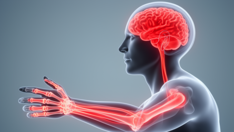 Rheumatoid Arthritis Inflammation Reaches the Brain in Rare Case Report