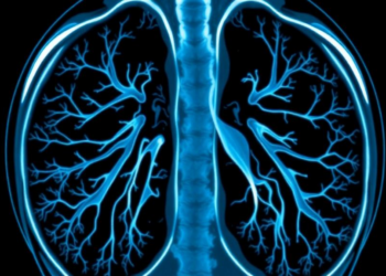 Leaner AI Reads Lung Scans: Optimized CNN Beats Heavyweight Models at Their Own Game