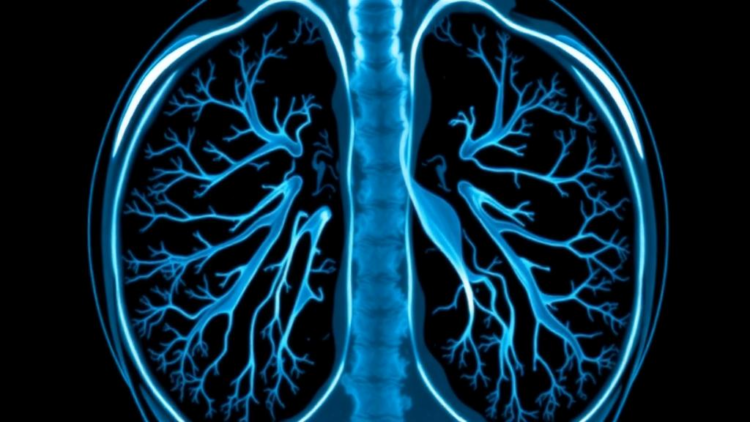Leaner AI Reads Lung Scans: Optimized CNN Beats Heavyweight Models at Their Own Game