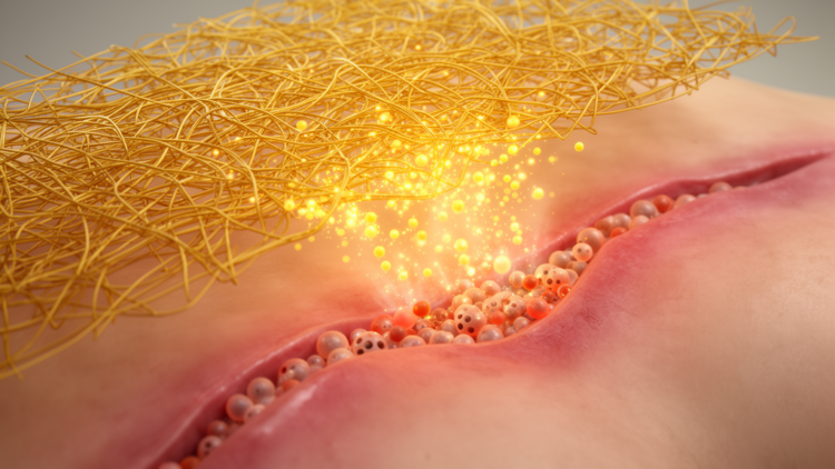 Turmeric-Powered Nanofiber Scaffold Rewires Infected Wounds to Heal Faster