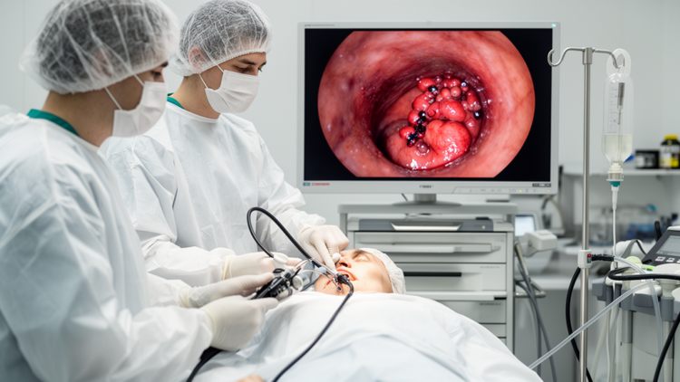 Doctors Stop Rare Genetic Bleeding Disorder With Endoscopic Sclerotherapy and Band Ligation