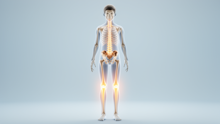 Hidden bone deficits in teens with congenital adrenal hyperplasia masked by fast-growing skeletons