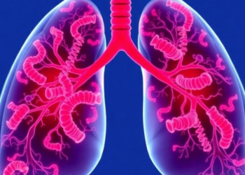 AI Model Links Calcium Pump Gene ATP2A2 to Immune Evasion in Lung Cancer