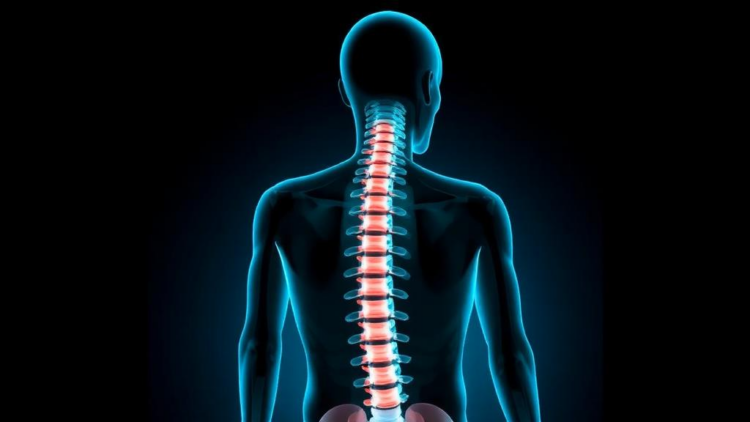 New Approaches to Spine Disorders Aim to Cut Disability and Rising Care Costs