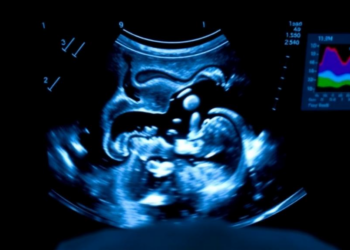 Ultrasound at the Bedside: Rethinking When Extra Fluid Actually Helps Failing Hearts