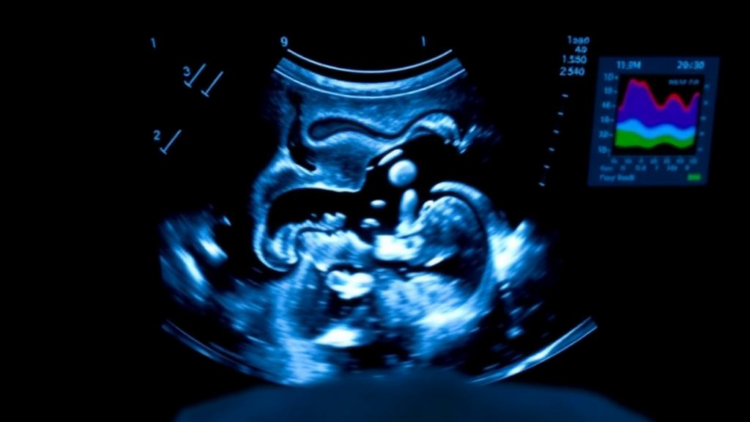Ultrasound at the Bedside: Rethinking When Extra Fluid Actually Helps Failing Hearts