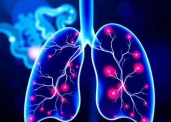Global Training Program Achieves High Agreement in PD-L1 Scoring for Lung Cancer