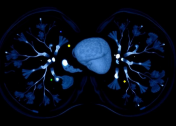 Early PET/CT Scan Predicts Which HER2-Positive Breast Cancers Will Vanish Before Surgery