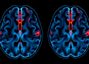Late Preterm Birth Leaves Subtle Traces in the Adolescent Brain, Landmark Imaging Study Finds