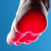 Single-Cell Sequencing Reveals Why Diabetic Foot Ulcers Refuse to Heal