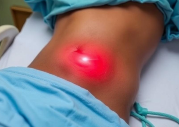Silent Pressure: Hidden Abdominal Hypertension Strikes Nearly Half of ICU Patients in Ghana