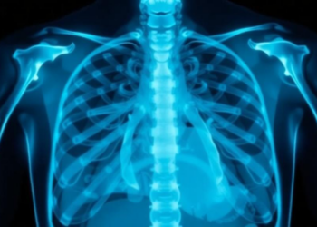 From AI X-Rays to Ultra-Short Drug Regimens: 2025’s Tuberculosis Breakthroughs