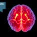 Enlarged Brain Choroid Plexus Emerges as a New Imaging Fingerprint of Metabolic Syndrome