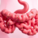Gut Microbes Take Center Stage in the Renamed Ovarian Syndrome PMOS