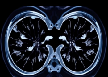 Micro-CT emerges as a promising tool for real-time breast cancer margin checks