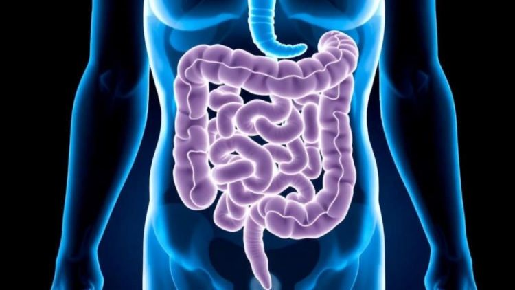 Standard-Dose Infliximab Edges Out Ciclosporin in Rescue Therapy Review for Severe Ulcerative Colitis