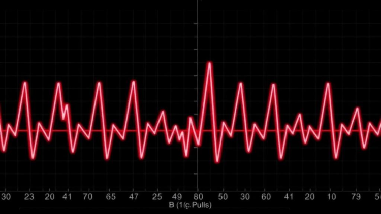 Asymmetric Biphasic Pulses Reshape Atrial Fibrillation Ablation in Landmark Chinese Trial