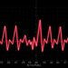 Asymmetric Biphasic Pulses Reshape Atrial Fibrillation Ablation in Landmark Chinese Trial