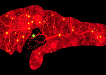 Single-Cell Atlas Maps the Inflammatory Immune Landscape of Biliary Atresia Livers