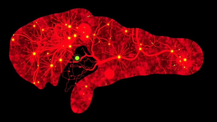 Single-Cell Atlas Maps the Inflammatory Immune Landscape of Biliary Atresia Livers