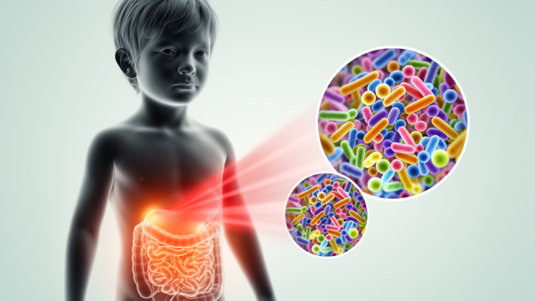 Near-Infrared Light Therapy Reshapes Gut Bacteria in a Child With Autism, Case Report Suggests