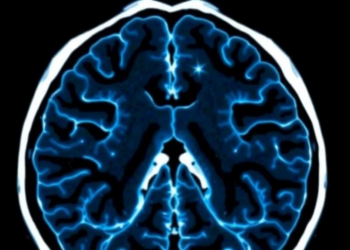AI Network Sharpens Detection of Dangerous Brain Aneurysms on CT Scans