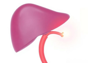 Stronger Chemo Dose Fails to Extend Survival in Liver Cancer Embolization Study