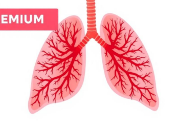 Arch-Shaped Lung Surgery Preserves Healthy Tissue in Children with Congenital Malformations