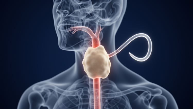 Primary tracheal lymphoepithelioma-like carcinoma in a young non-smoking male: a case report highlighting the diagnostic value of flow-volume loop