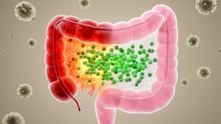 Glucagon like peptide 1 receptor agonists in patients with inflammatory bowel disease: safety, clinical effectiveness and anti-inflammatory mechanisms