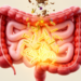 Ancient Four-Herb Formula Heals Colitis by Feeding Gut Microbes That Activate AhR