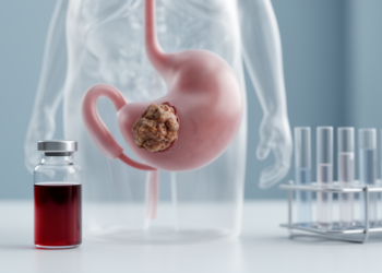 Normal PSA Did Not Save Him: Bladder Cancer Masquerading as Prostate Disease