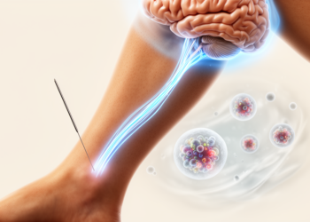 Electroacupuncture Calms Stroke Inflammation by Silencing the TLR/TRAF6/NF-κB Pathway