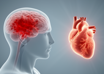 Poor Blood Pressure Control May Drive Fatal Brain Bleeds in Anticoagulated AF Patients