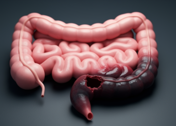 Cocaine’s Hidden Toll: How the Drug Ravages the Gut From Ischemia to Perforation