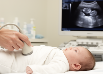 Multihipposenet: multi-task deep learning for automated DDH assessment in infant hip ultrasound