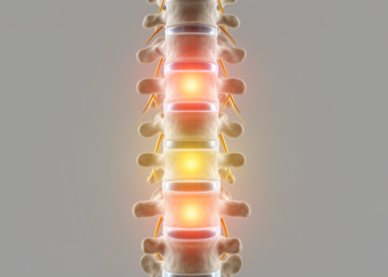 Chronic Low Back Pain May Not Come From One Tissue, But From Four Distinct Pain Niches