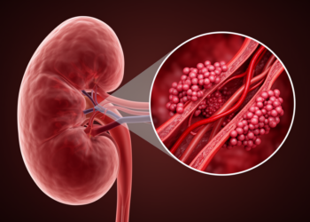 When a Complement Blocker Fails: Malignant Hypertension and a Hidden Blood Protein Behind a Rare Kidney Disease